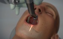 Yomi, The First Robotic Dental Surgery System Now Cleared by FDA