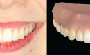 Disney Research Software Turns Photos Into Digital Dental Impressions