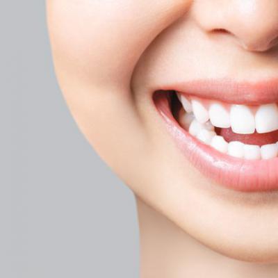 Doskonaly Usmiech Zdrowych Zebow Mlodej Kobiety Azjatyckiej Wybielanie Zebow Pacjent Kliniki Stomatologicznej Wizerunek 168410 1191